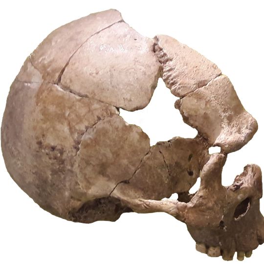 Schädel von Rhünda